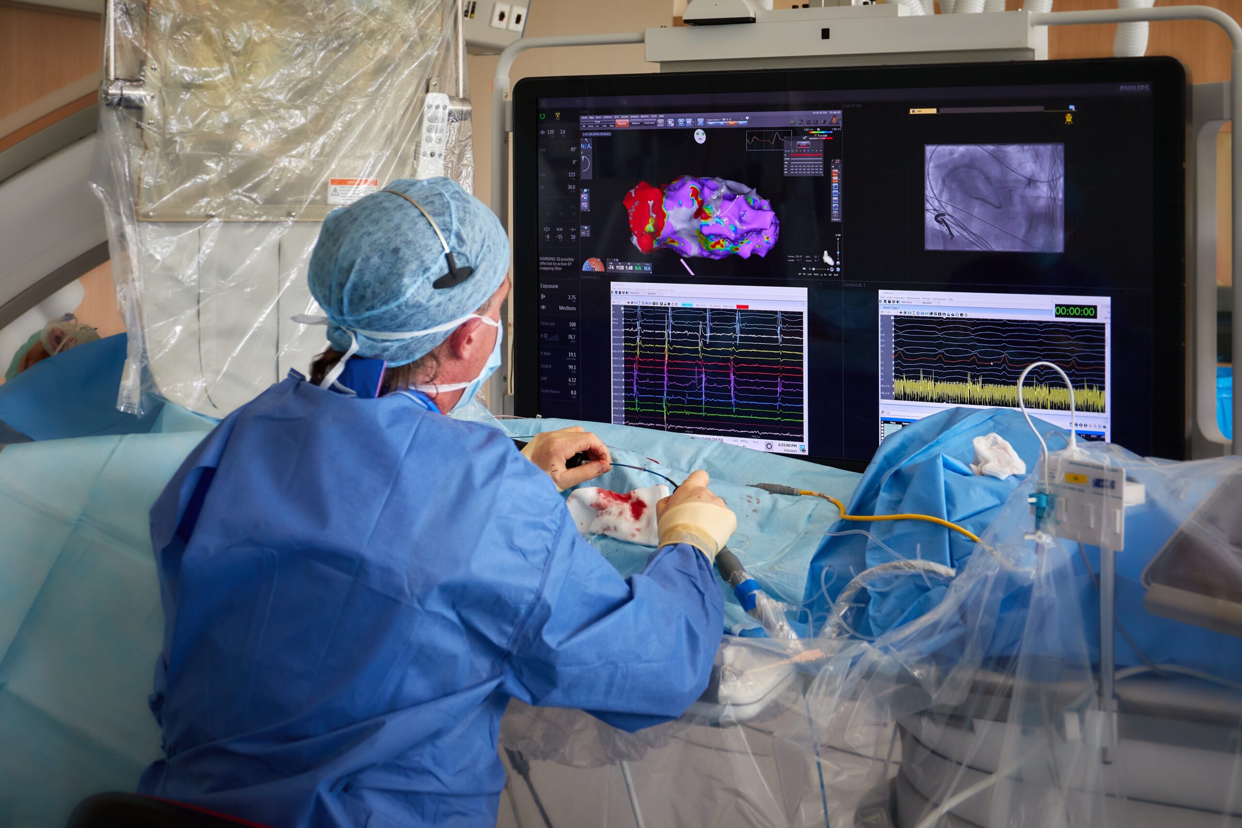 HighRes_20230725-JV-BECAstudie-0005